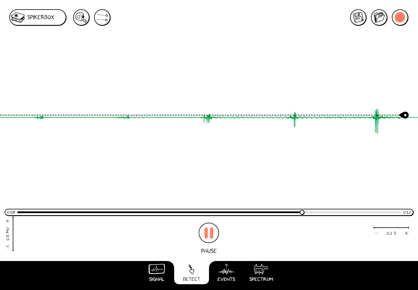 Detect workspace with a green trace, dashed threshold, right-edge threshold handle, and playback controls.