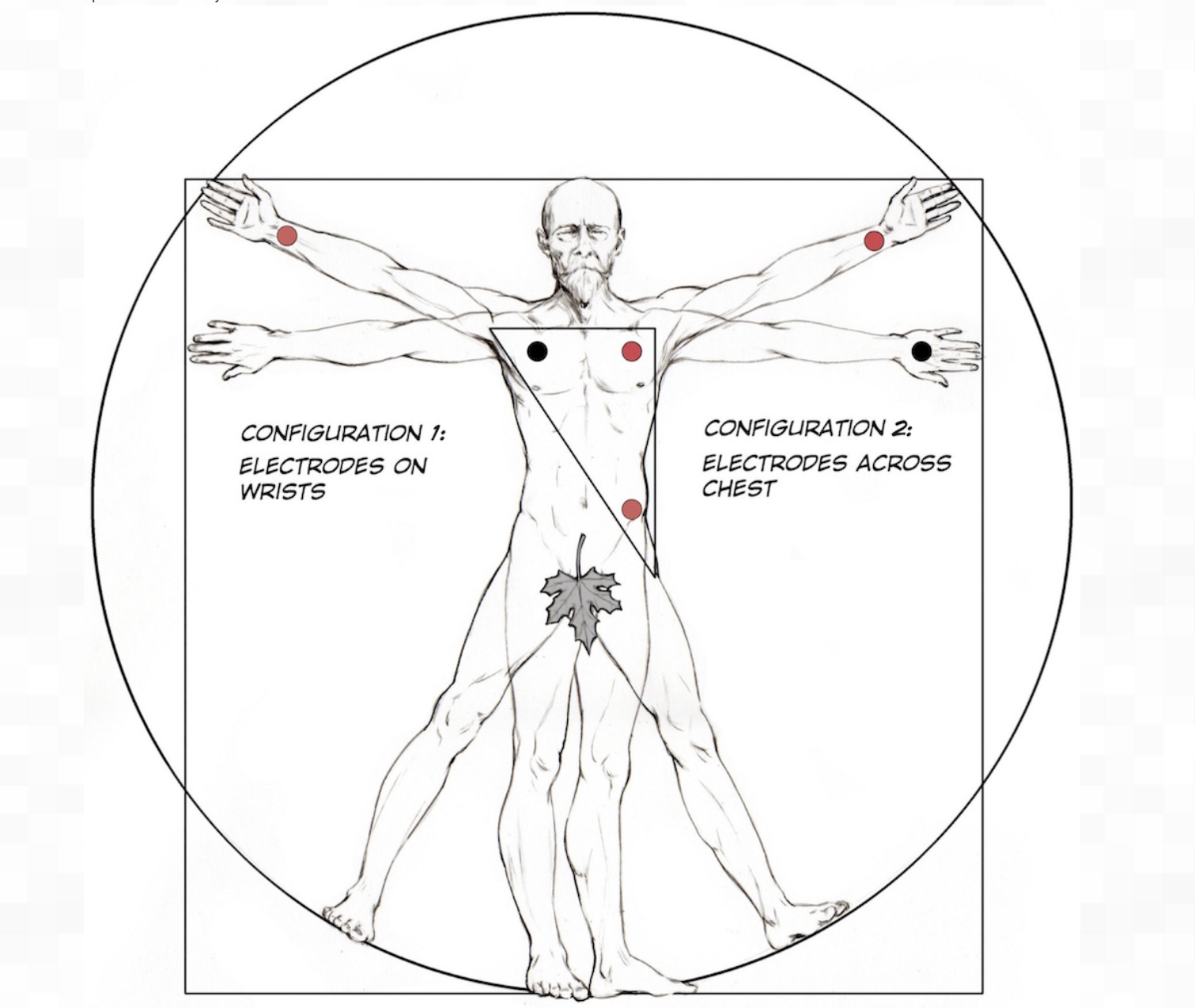 ECGPlacement