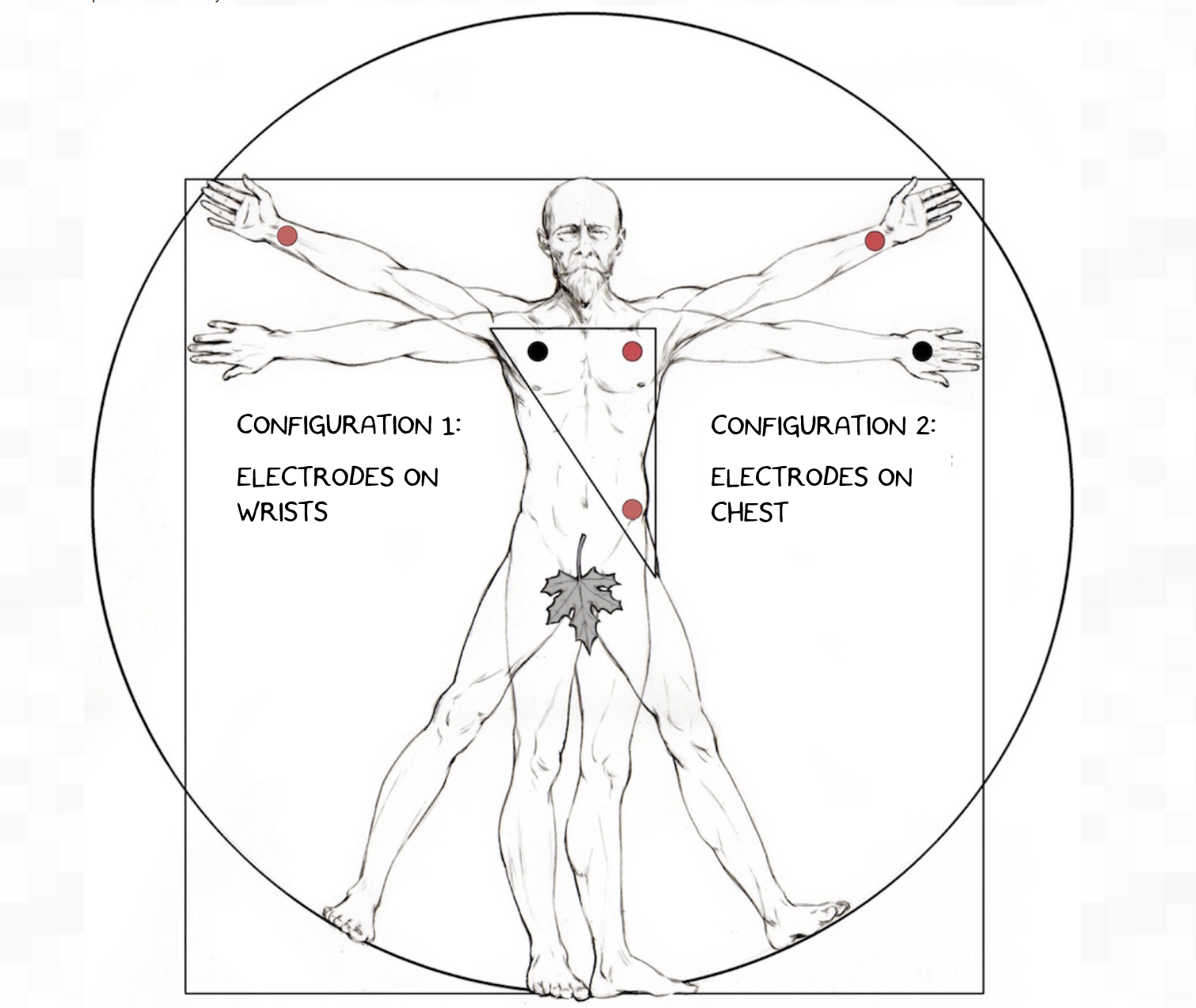ECGPlacement