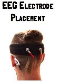 EEG placement