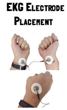 EKG placement