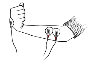 muscle electrode placement