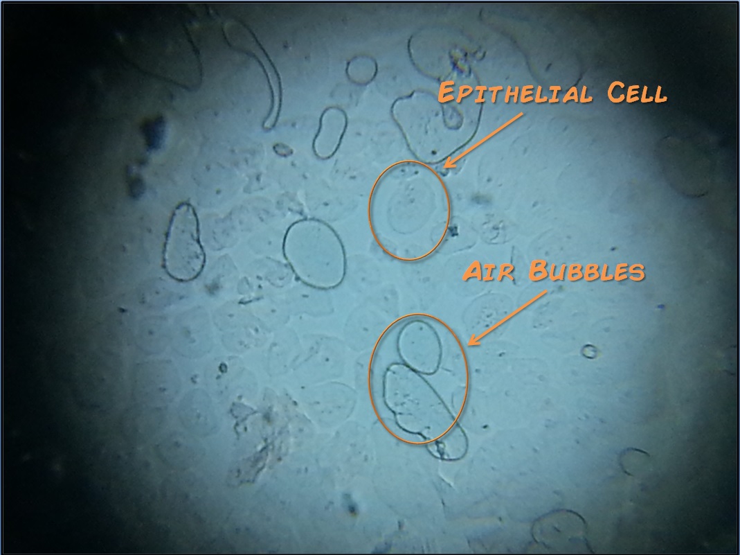 Epithelial annot